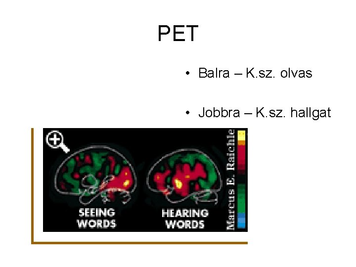 PET • Balra – K. sz. olvas • Jobbra – K. sz. hallgat 