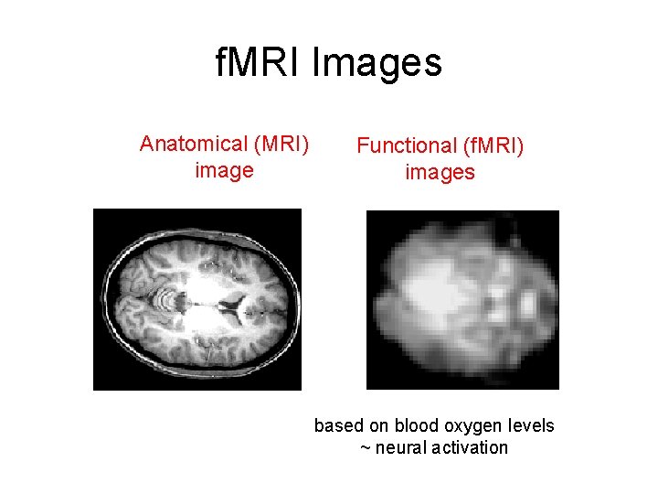 f. MRI Images Anatomical (MRI) image Functional (f. MRI) images based on blood oxygen