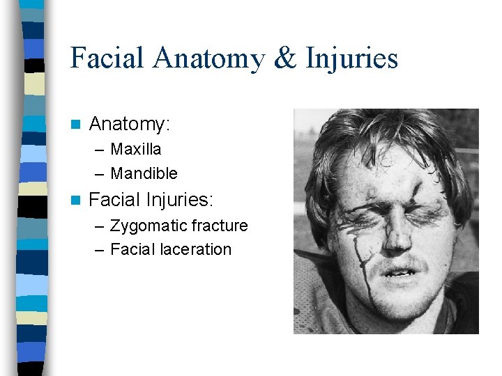 Facial Anatomy & Injuries n Anatomy: – Maxilla – Mandible n Facial Injuries: –