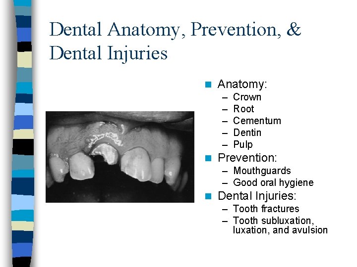 Dental Anatomy, Prevention, & Dental Injuries n Anatomy: – – – n Crown Root