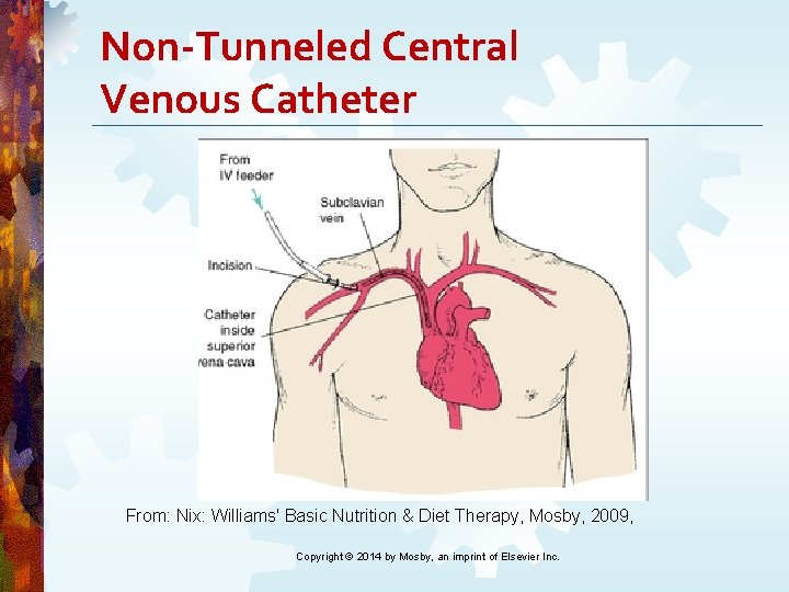 Non-Tunneled Central Venous Catheter From: Nix: Williams' Basic Nutrition & Diet Therapy, Mosby, 2009, Non-Tunneled Central Venous Catheter From: Nix: Williams' Basic Nutrition & Diet Therapy, Mosby, 2009,