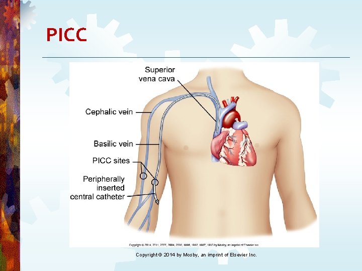 PICC Copyright © 2014 by Mosby, an imprint of Elsevier Inc. PICC Copyright © 2014 by Mosby, an imprint of Elsevier Inc.
