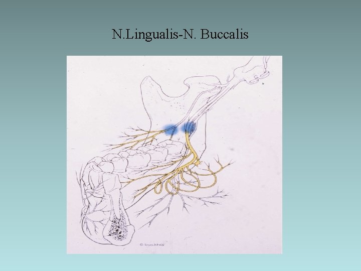 N. Lingualis-N. Buccalis 