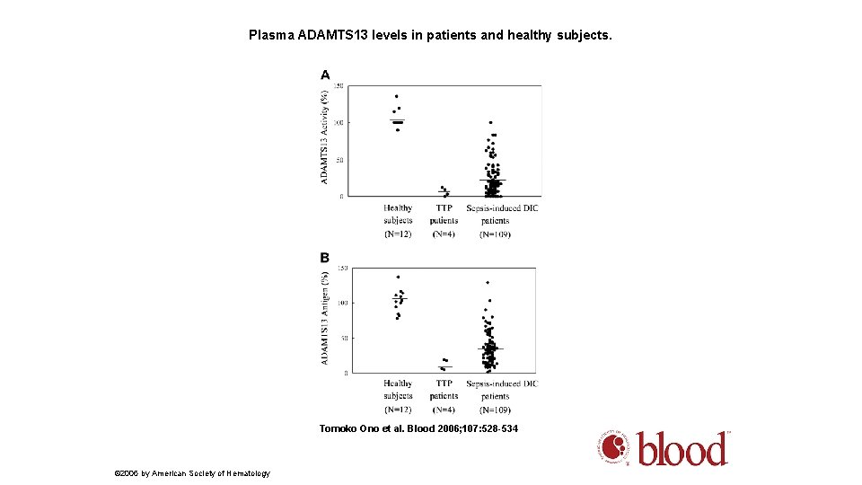 Plasma ADAMTS 13 levels in patients and healthy subjects. Tomoko Ono et al. Blood