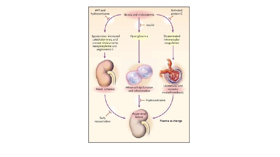 Plasma exchange 