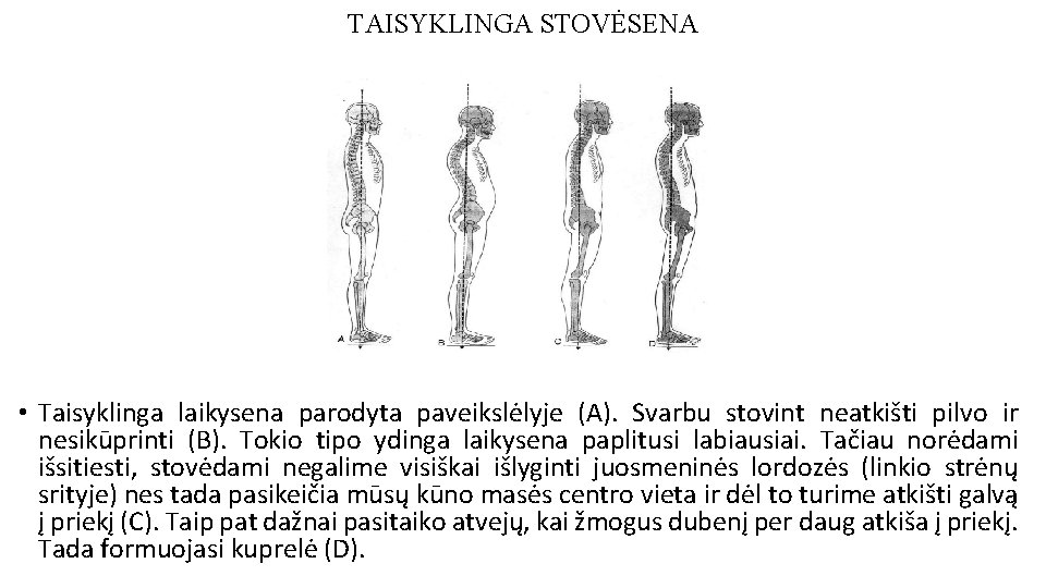 TAISYKLINGA STOVĖSENA • Taisyklinga laikysena parodyta paveikslėlyje (A). Svarbu stovint neatkišti pilvo ir nesikūprinti