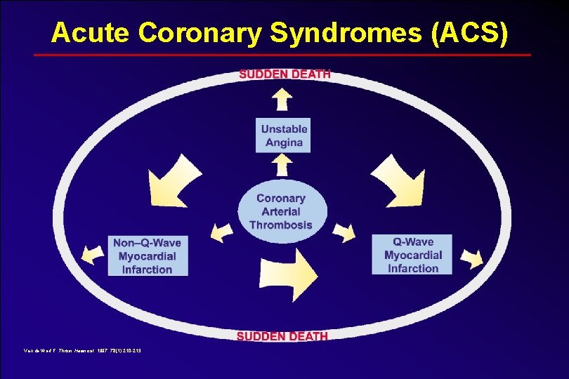 Acute Coronary Syndromes (ACS) Van de Werf F. Throm Haemost. 1997; 78(1): 210 -213.