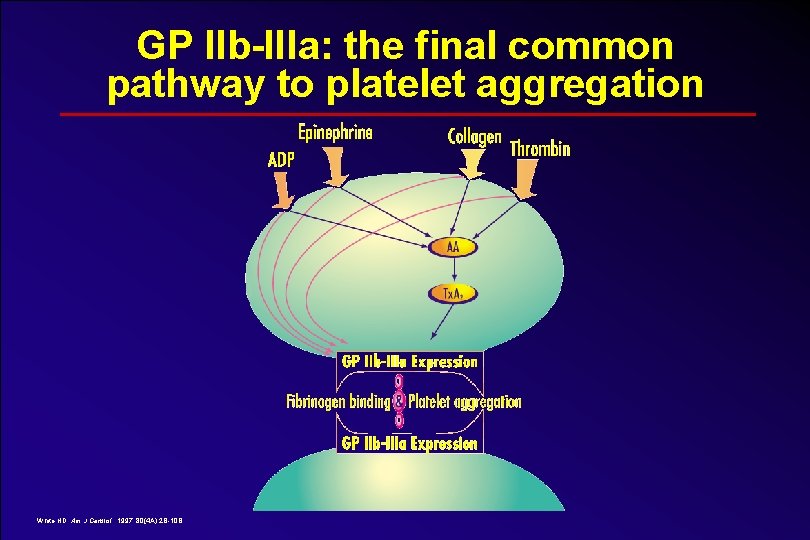 GP IIb-IIIa: the final common pathway to platelet aggregation White HD. Am J Cardiol.