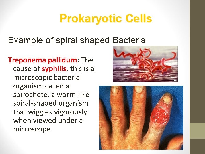 Prokaryotic Cells Example of spiral shaped Bacteria Treponema pallidum: The cause of syphilis, this