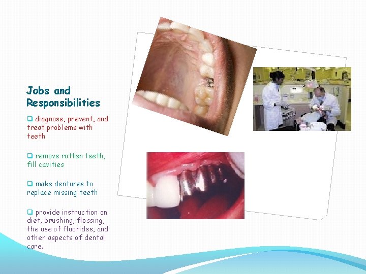 Jobs and Responsibilities q diagnose, prevent, and treat problems with teeth q remove rotten