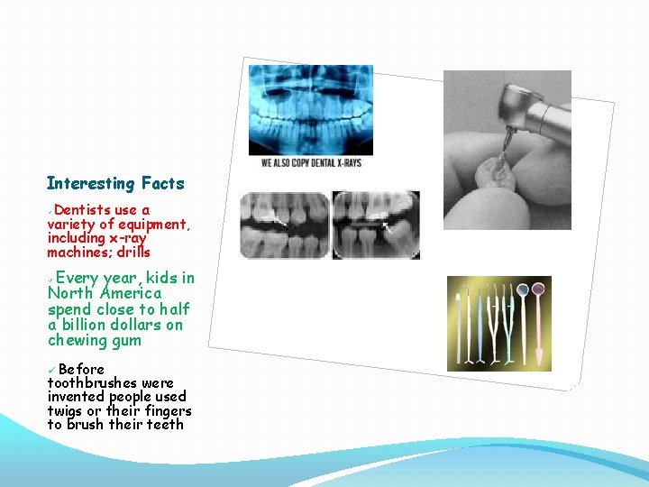 Interesting Facts Dentists use a variety of equipment, including x-ray machines; drills ü Every