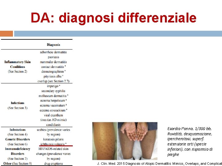 DA: diagnosi differenziale Esordio I°anno, 1/300 bb, Ruvidità, desquamazione, ipercheratosi, superf. estensiorie arti (specie