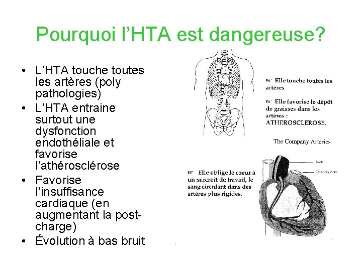 Pourquoi l’HTA est dangereuse? • L’HTA touche toutes les artères (poly pathologies) • L’HTA