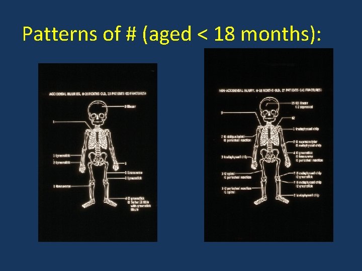 Patterns of # (aged < 18 months): 