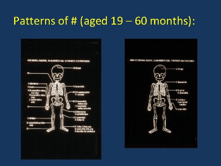 Patterns of # (aged 19 – 60 months): 