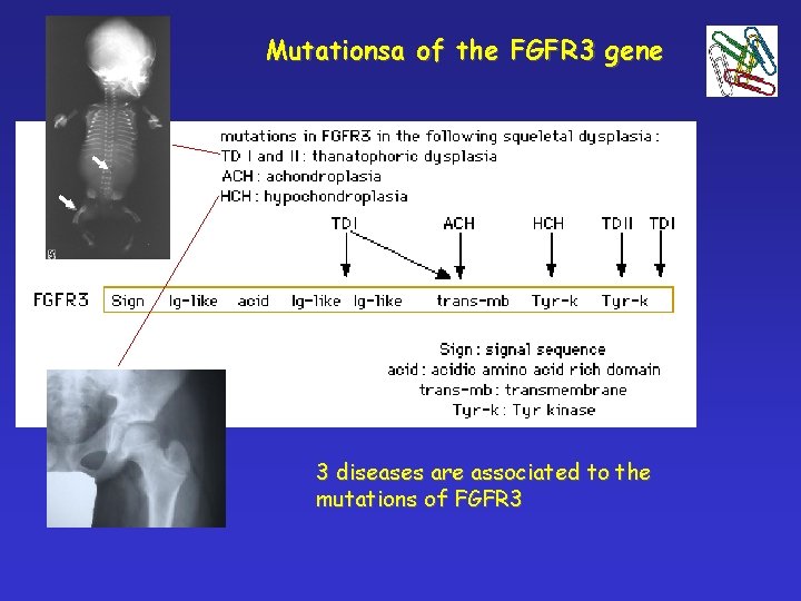 Mutationsa of the FGFR 3 gene 3 diseases are associated to the mutations of
