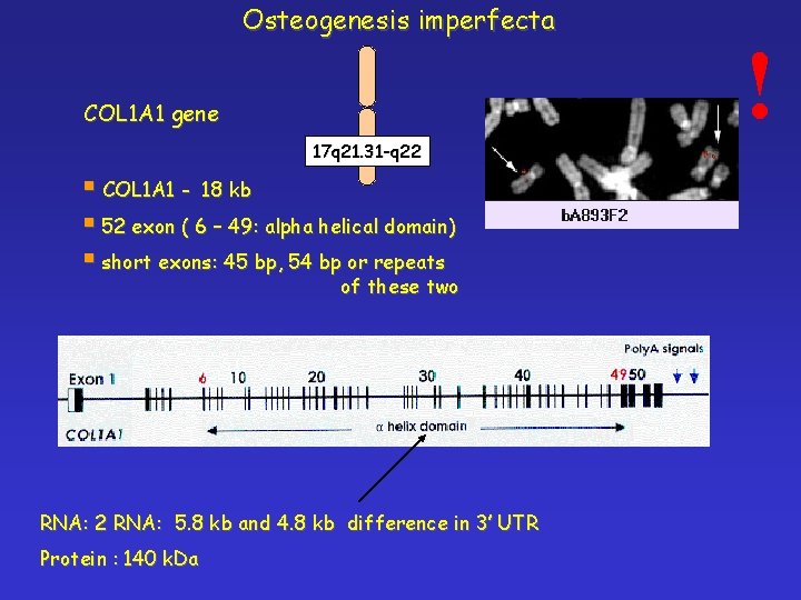 Osteogenesis imperfecta COL 1 A 1 gene 17 q 21. 31 -q 22 §