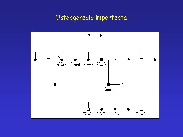 Osteogenesis imperfecta 