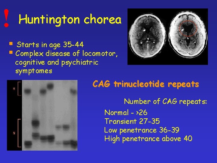! Huntington chorea § Starts in age 35 -44 § Complex disease of locomotor,