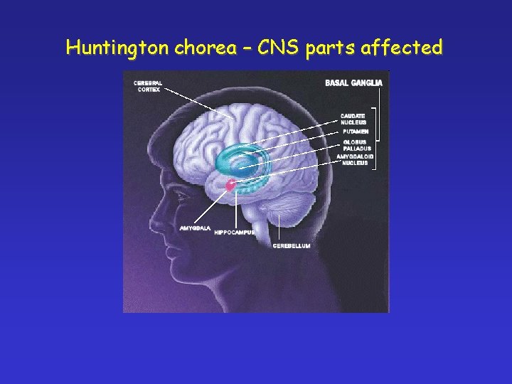 Huntington chorea – CNS parts affected 