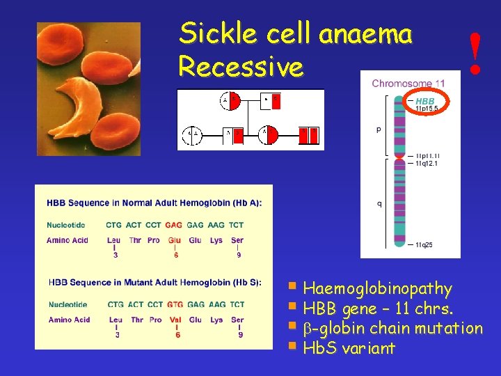 Sickle cell anaema Recessive ! § Haemoglobinopathy § HBB gene – 11 chrs. §