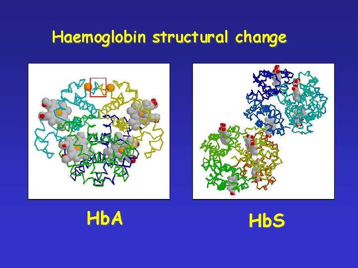 Haemoglobin structural change Hb. A Hb. S 