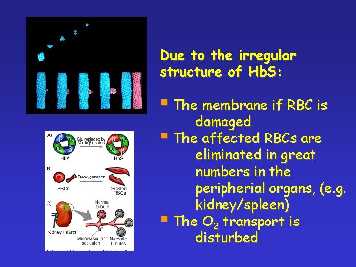 Due to the irregular structure of Hb. S: § The membrane if RBC is