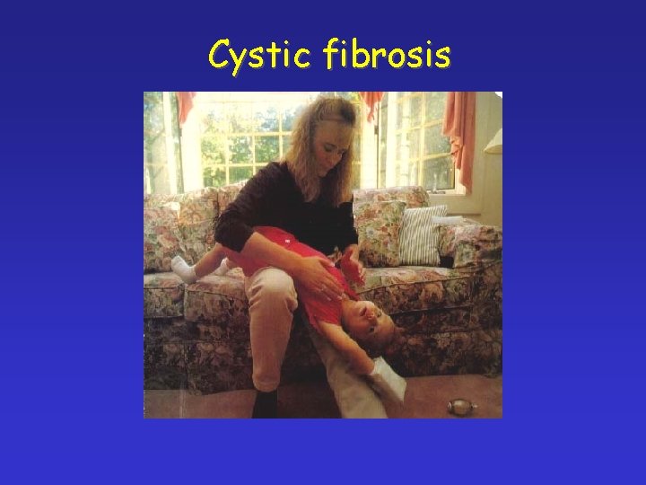 Cystic fibrosis 