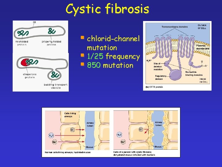 Cystic fibrosis § chlorid-channel mutation § 1/25 frequency § 850 mutation 