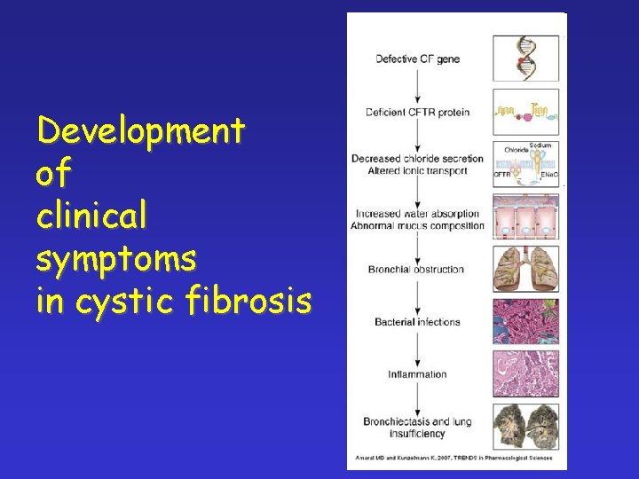 Development of clinical symptoms in cystic fibrosis 