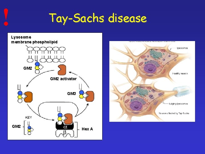 ! Tay-Sachs disease Lysosome membrane phospholipid GM 2 activator GM 3 GM 2 Hex