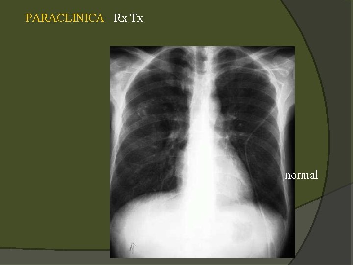 PARACLINICA Rx Tx normal 