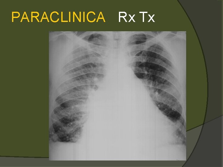 PARACLINICA Rx Tx 