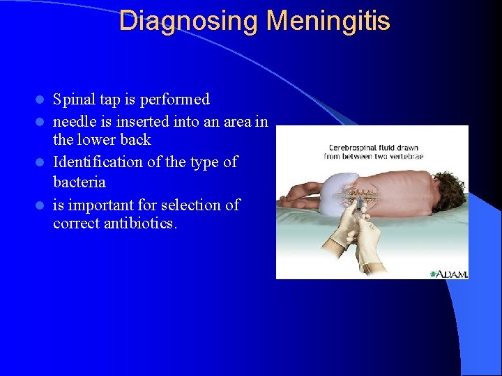 Diagnosing Meningitis Spinal tap is performed l needle is inserted into an area in