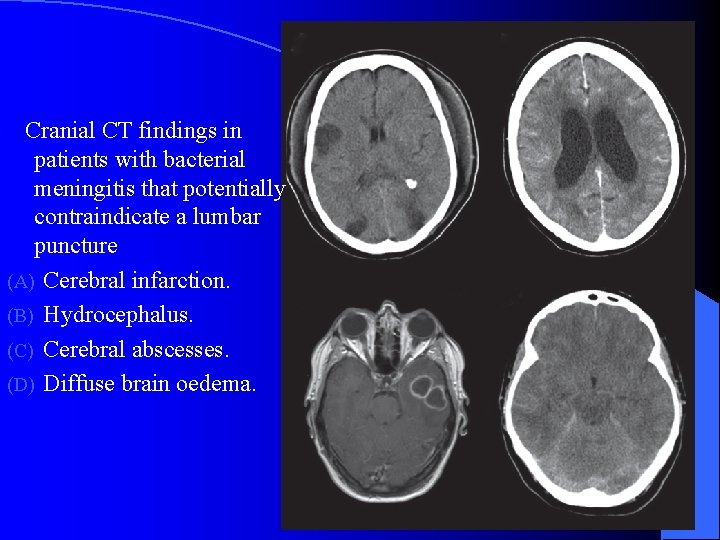 Cranial CT findings in patients with bacterial meningitis that potentially contraindicate a lumbar puncture