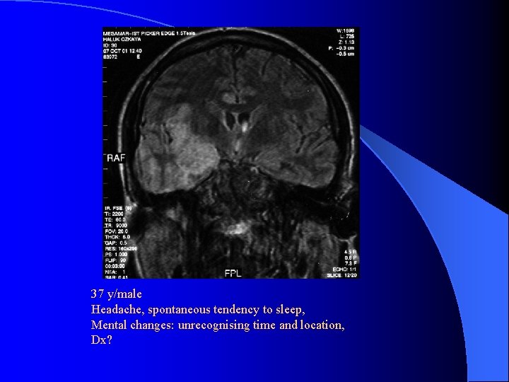 37 y/male Headache, spontaneous tendency to sleep, Mental changes: unrecognising time and location, Dx?