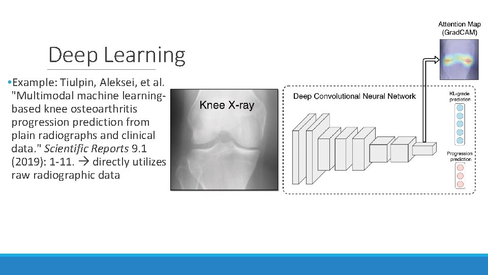 Deep Learning • Example: Tiulpin, Aleksei, et al. "Multimodal machine learningbased knee osteoarthritis progression