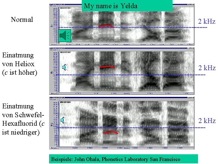 My name is Yelda Normal 2 k. Hz Einatmung von Heliox (c ist höher)