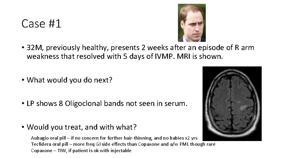 Case #1 • 32 M, previously healthy, presents 2 weeks after an episode of