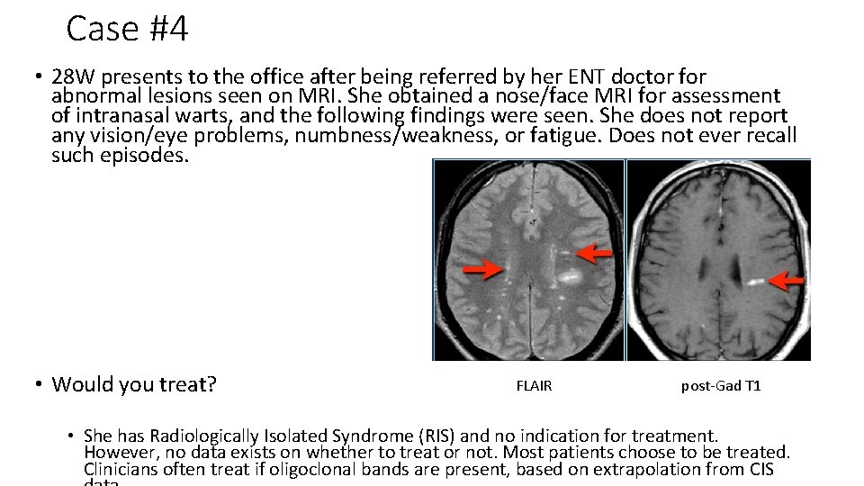 Case #4 • 28 W presents to the office after being referred by her