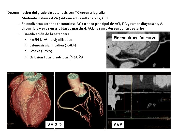 Determinación del grado de estenosis con TC coronariografia – Mediante sistema AVA ( Advanced