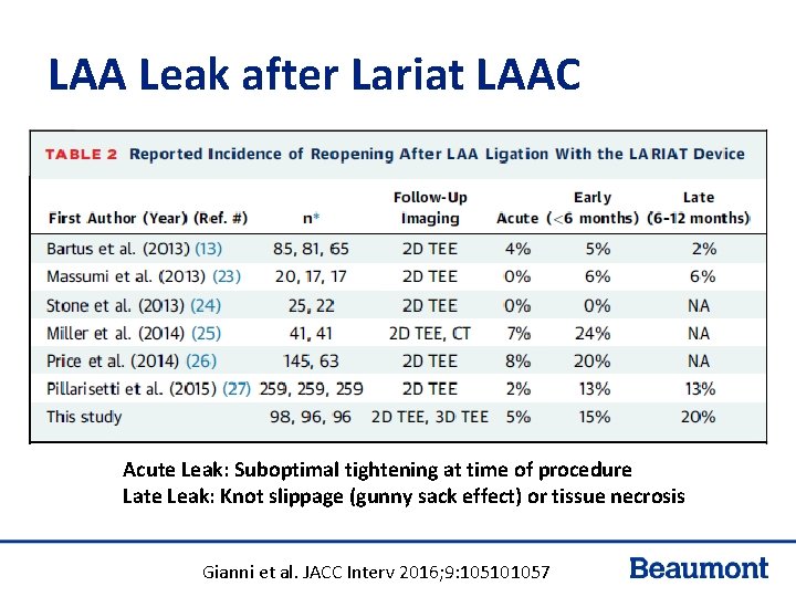 LAA Leak after Lariat LAAC Acute Leak: Suboptimal tightening at time of procedure Late LAA Leak after Lariat LAAC Acute Leak: Suboptimal tightening at time of procedure Late