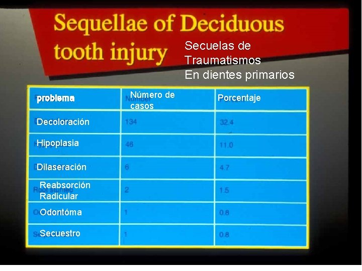61 Secuelas de Traumatismos En dientes primarios problema Decoloración Hipoplasia Dilaseración Reabsorción Radicular Odontóma 61 Secuelas de Traumatismos En dientes primarios problema Decoloración Hipoplasia Dilaseración Reabsorción Radicular Odontóma