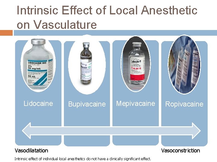 Intrinsic Effect of Local Anesthetic on Vasculature Lidocaine Bupivacaine Mepivacaine Vasodilatation Intrinsic effect of