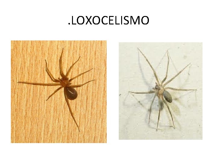 . LOXOCELISMO 