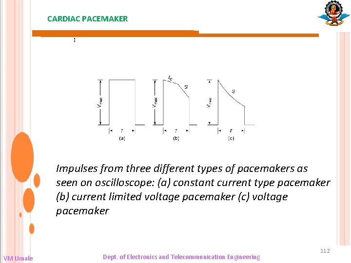 CARDIAC PACEMAKER : Impulses from three different types of pacemakers as seen on oscilloscope: