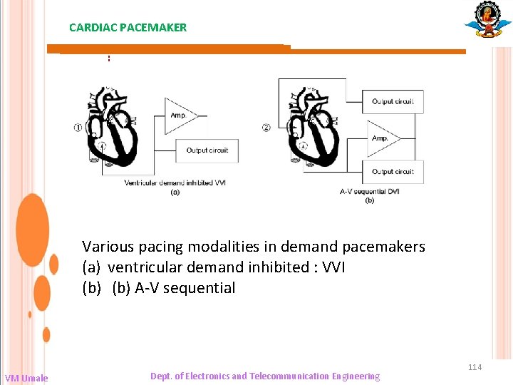 CARDIAC PACEMAKER : Various pacing modalities in demand pacemakers (a) ventricular demand inhibited :