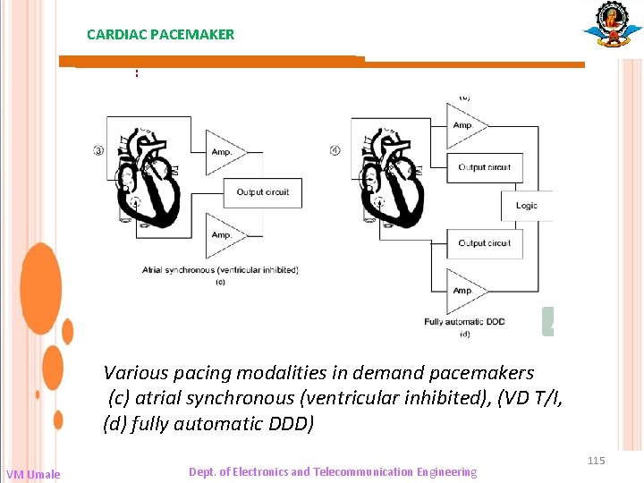 CARDIAC PACEMAKER : Various pacing modalities in demand pacemakers (c) atrial synchronous (ventricular inhibited),
