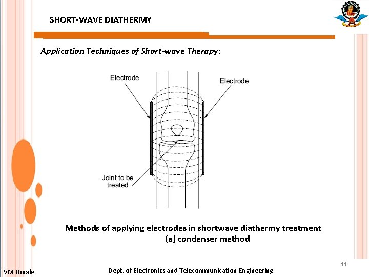 SHORT-WAVE DIATHERMY Application Techniques of Short-wave Therapy: Methods of applying electrodes in shortwave diathermy