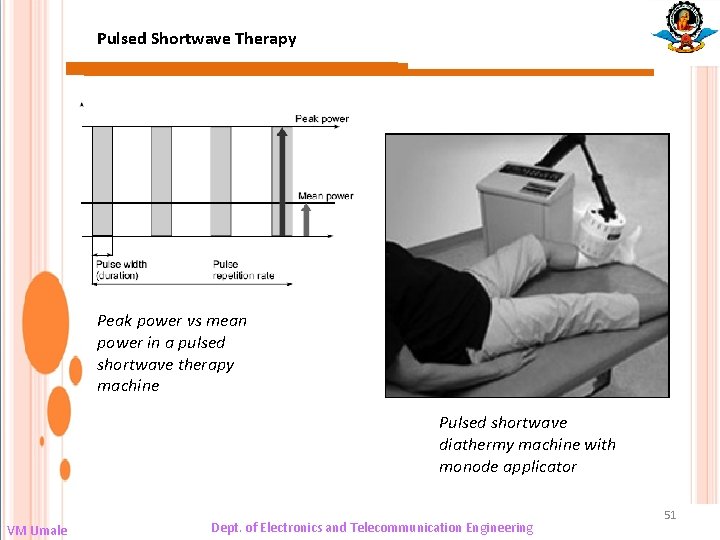 Pulsed Shortwave Therapy Peak power vs mean power in a pulsed shortwave therapy machine